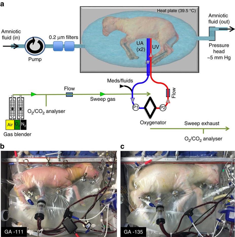 Schema di funzionamento di un utero artificiale